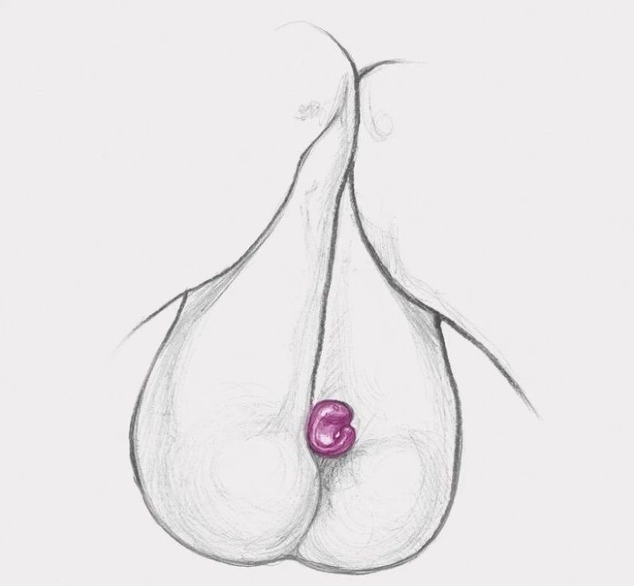GringXL is an exciting combination of finger vibrator and re... Gvibe - Gring XL - Raspberry photo-7