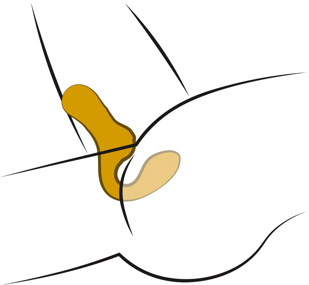 Simultaneously stimulates the vagina and clitoris!
Dynamic, ... YNF - Double Vibrator - Yellow photo-9