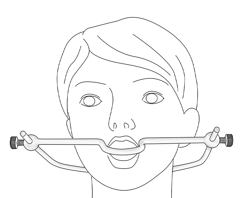 Stainless steel mouth gag MT - Metal Mouth Clip - Silver photo-2