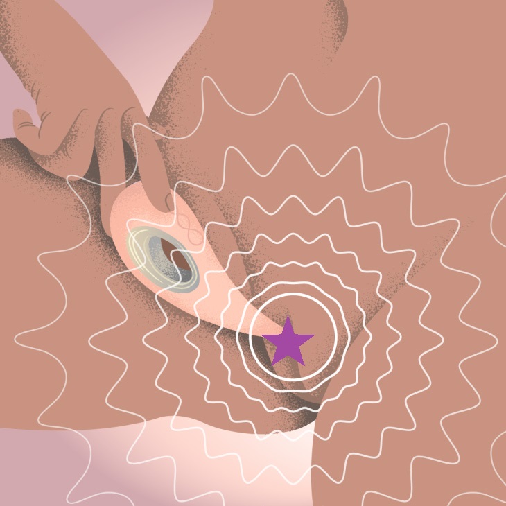 LELO DOT Cruise is the upgraded version of a groundbreaking ... Lelo - DOT Cruise Clitoral Vibrator - Lemon Sorbet photo-5