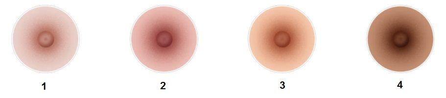 Areola color Areola color