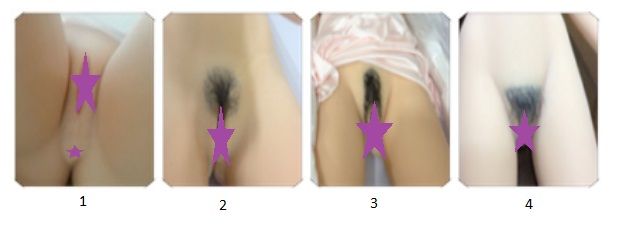 Pubic hair Pubic hair
