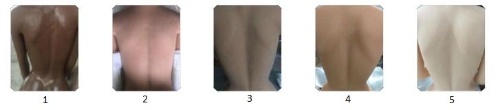Skin tone Skin tone