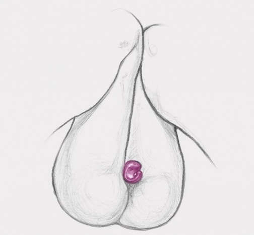 Gvibe - Gring XL - Raspberry photo