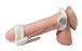 Jes-Extender - Original Penis Enlarger photo-3