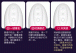 Erocome - UrsaMinor - Egg - Purple photo-32